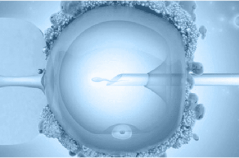 Интрацитоплазматическая инъекция морфологически нормального сперматозоида - ИМСИ